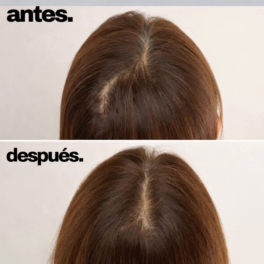 Masajeador Capilar con Luz Roja Terapéutica